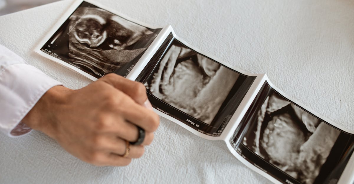 erfahren sie alles über die verschiedenen schwangerschaftswochen, einschließlich entwicklungen des babys, körperliche veränderungen der mutter und wichtige tipps für werdende eltern. begleiten sie uns auf dieser spannenden reise durch die schwangerschaft!